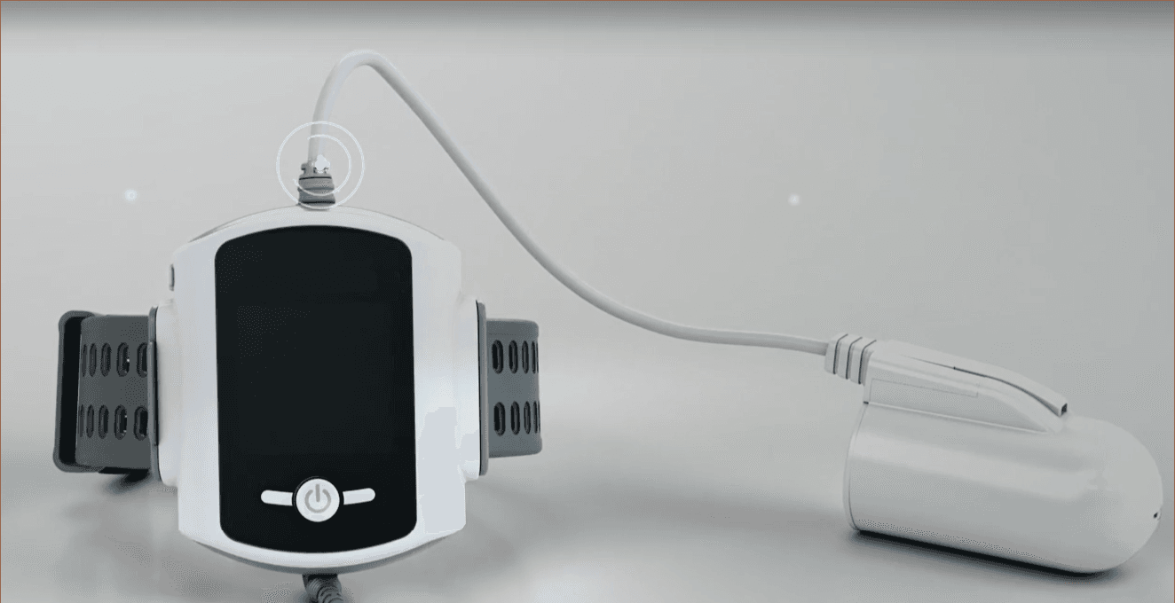 At-Home Sleep Apnea Test